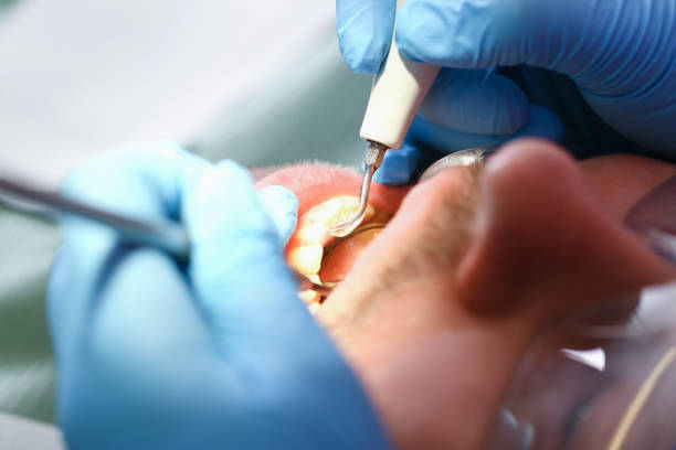 Best Broken Tooth Emergency  in Tuolumne City, CA